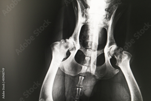 x-ray
