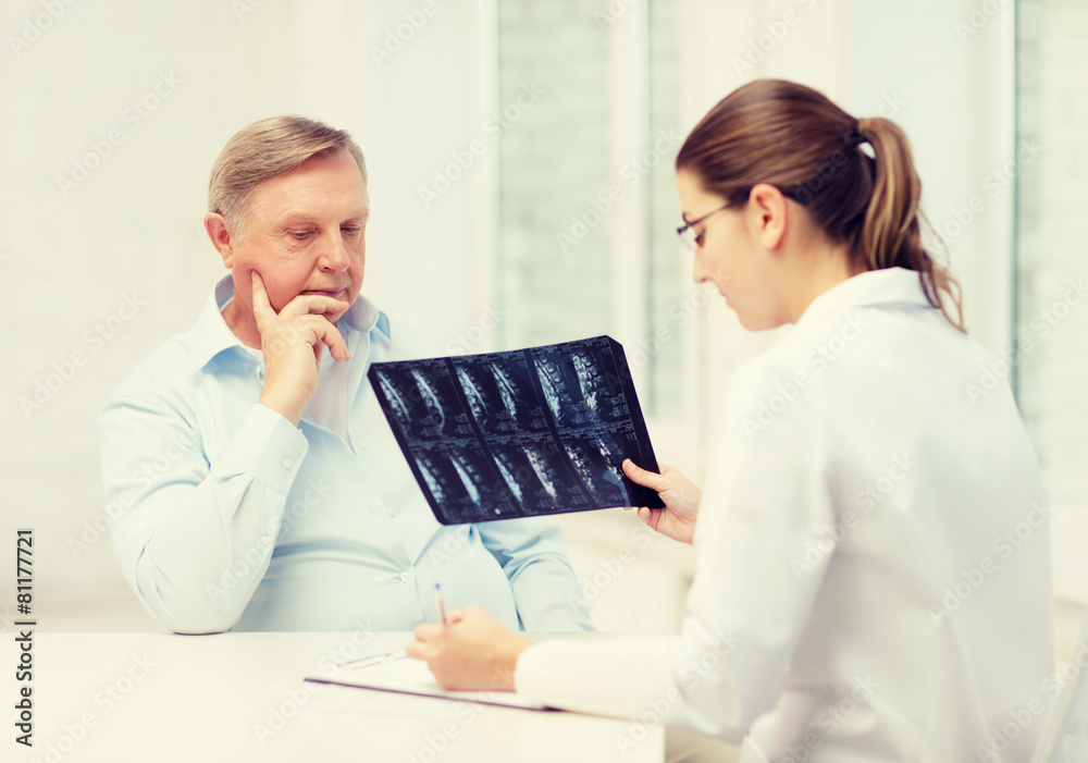 Obraz premium female doctor with old man looking at x-ray