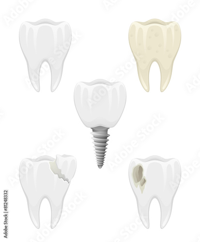 Dental problems