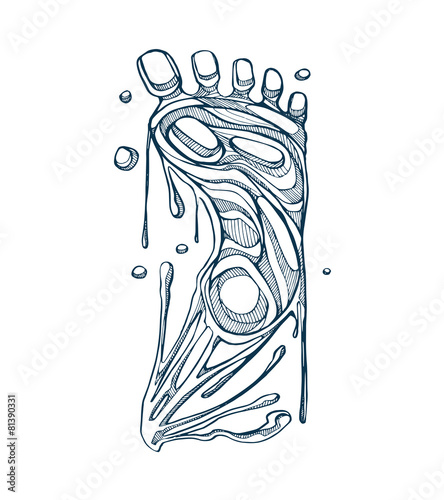 Melting foot