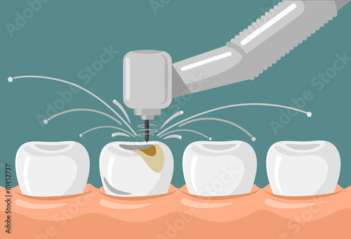Vector dental flat illustration