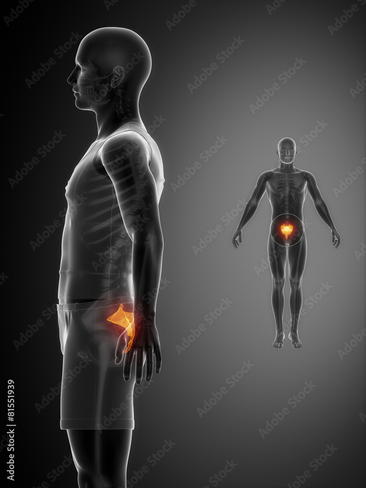 SACRUM black x--ray bone scan SACRUM black x--ray bone scan