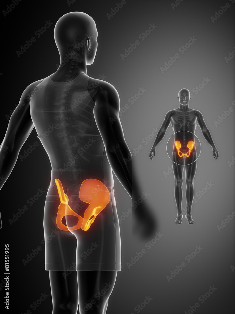 PELVIS black x--ray bone scan PELVIS black x--ray bone scan