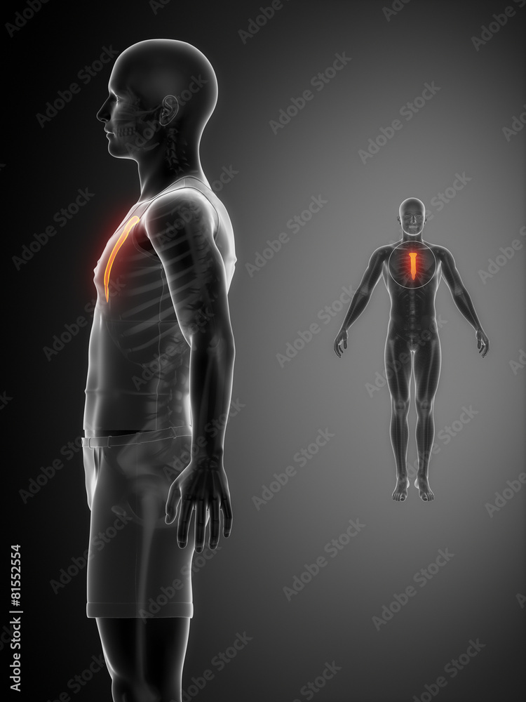 STERNUM black x--ray bone scan STERNUM black x--ray bone scan