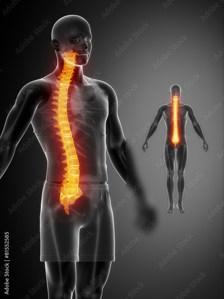 SPINE black x--ray bone scan SPINE black x--ray bone scan