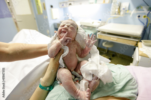 Vernix covered newborn after delivery