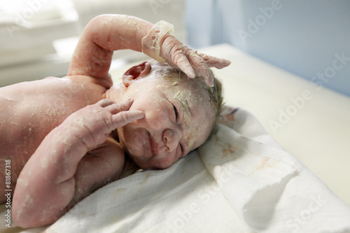 Obraz na płótnie Vernix covered newborn after delivery w salonie