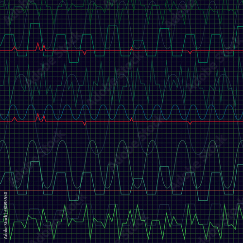 Heartbeat