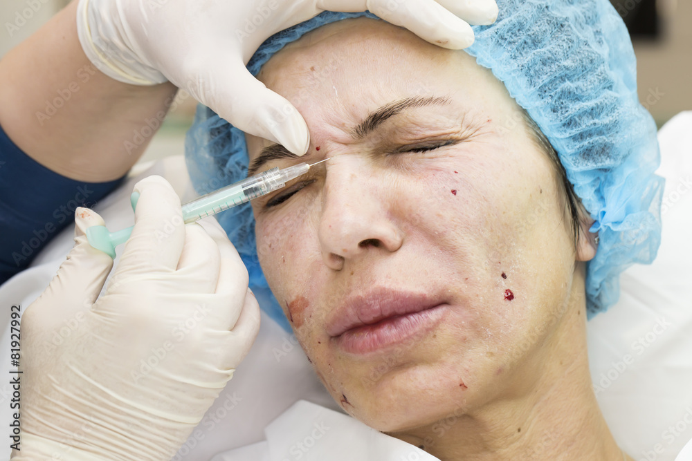 Cosmetic treatment with injection in a clinic Cosmetic treatment with injection in a clinic