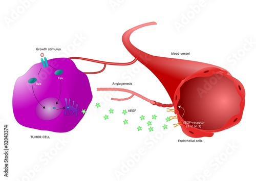 angiogenesi: meccanismi di crescita del tumore © ellepigrafica