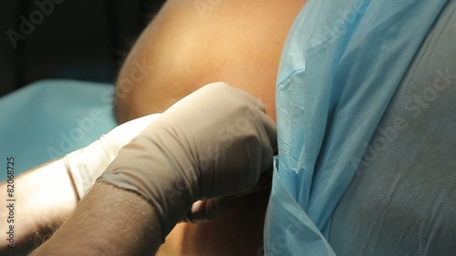 Spinal Anesthesia
