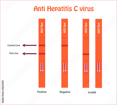 Anti Hepatitis C virus strip test