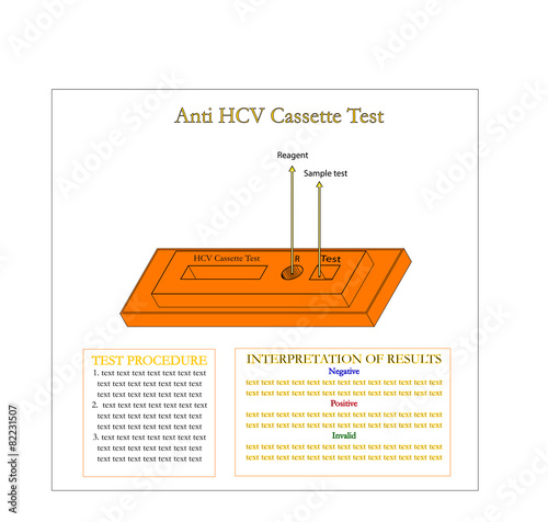 Anti Hepatitis C virus cassette for laboratory test,Vector