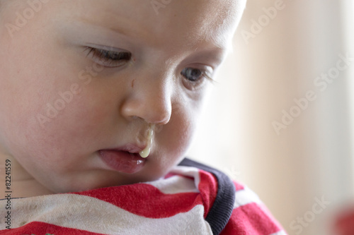 Tableau sur toile Toddler with snot hanging out of nose