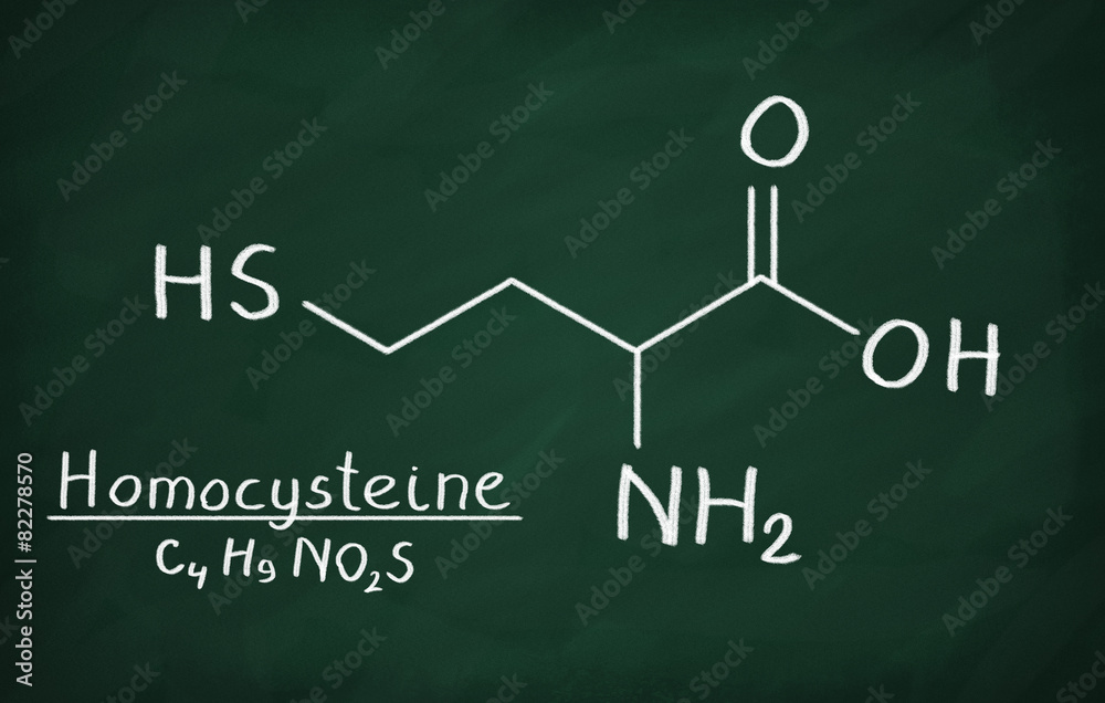 Chemical formula of Homocysteine on a blackboard Chemical formula of Homocysteine on a blackboard