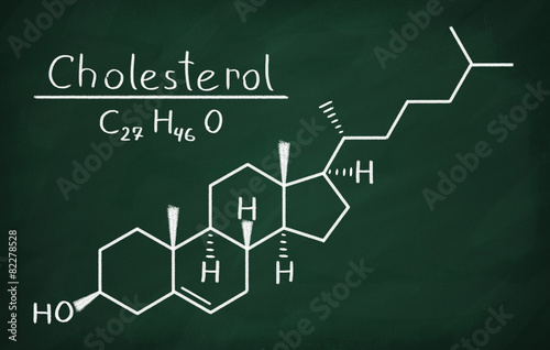 Chemical formula of Cholesterol on a blackboard