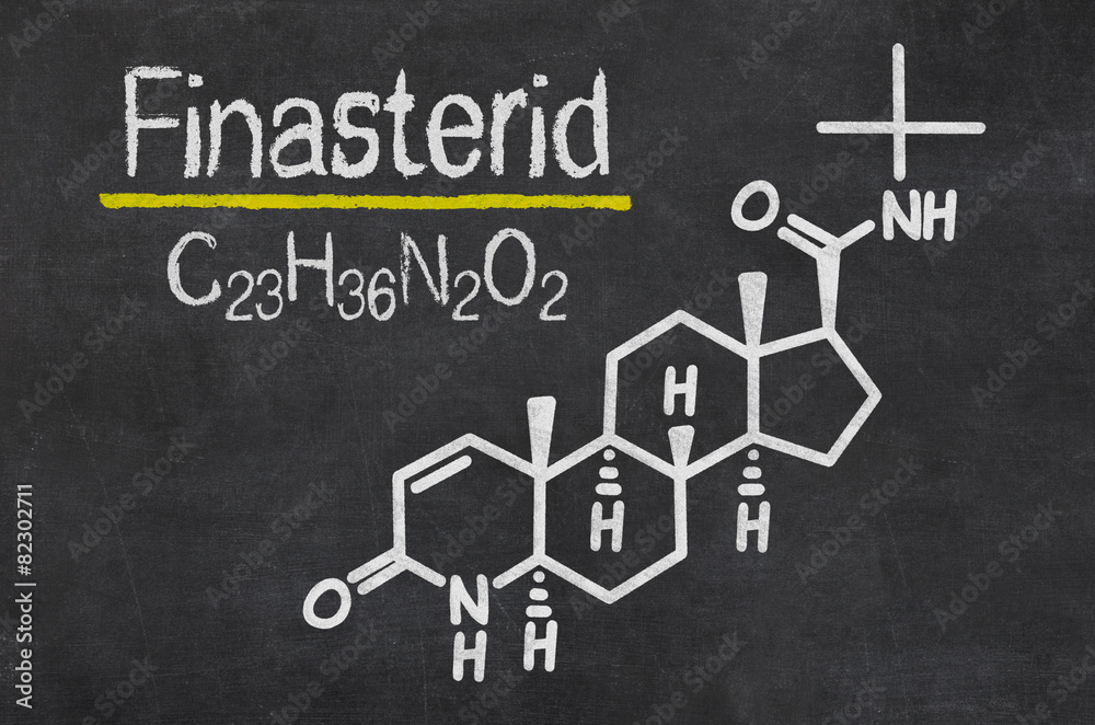 Schiefertafel mit der chemischen Formel von Finasterid Schiefertafel mit der chemischen Formel von Finasterid