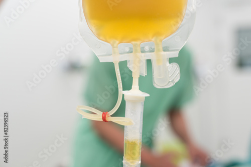 giving fresh frozen plasma blood components during surgery