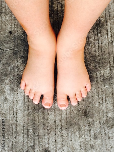 Fototapeta swollen foot of pregnancy