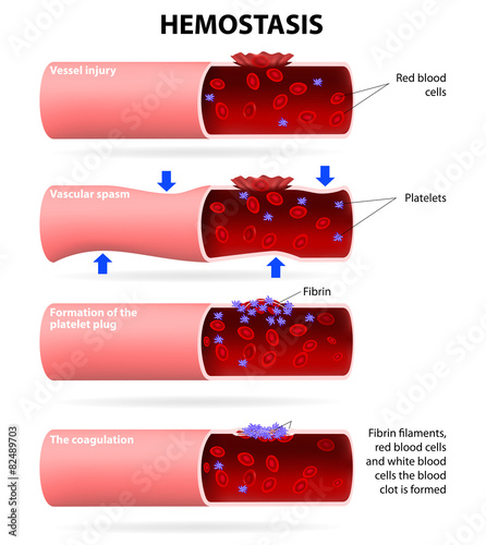 Basic steps in hemostasis photo