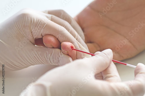Hematocrit blood test