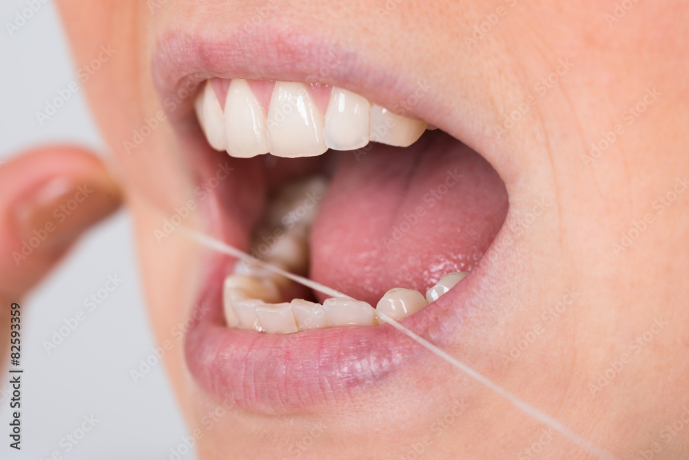 © Andrey Popov - Woman Flossing Teeth © Andrey Popov - Woman Flossing Teeth