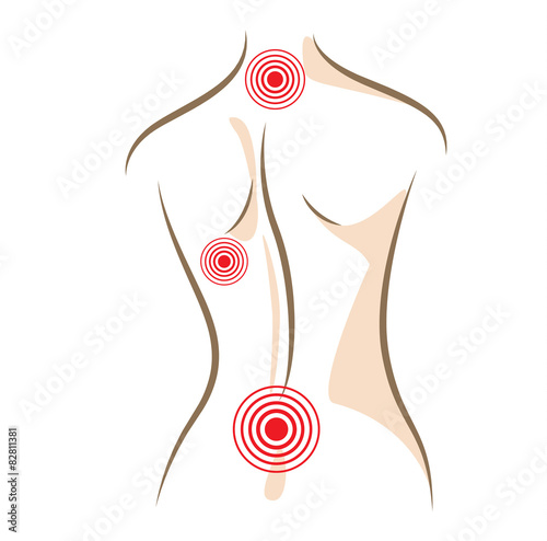 Concept of woman back pain vector sketch