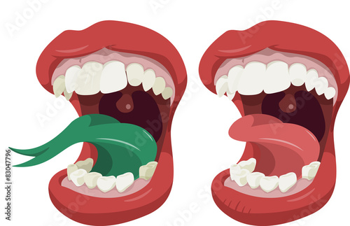 Big mouth
