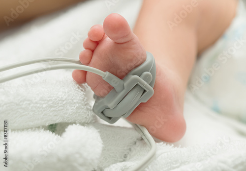 Pulse oximeter sensor on a baby foot photo