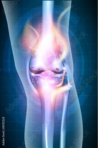 Burning leg knee joint on a abstract blue checkered background