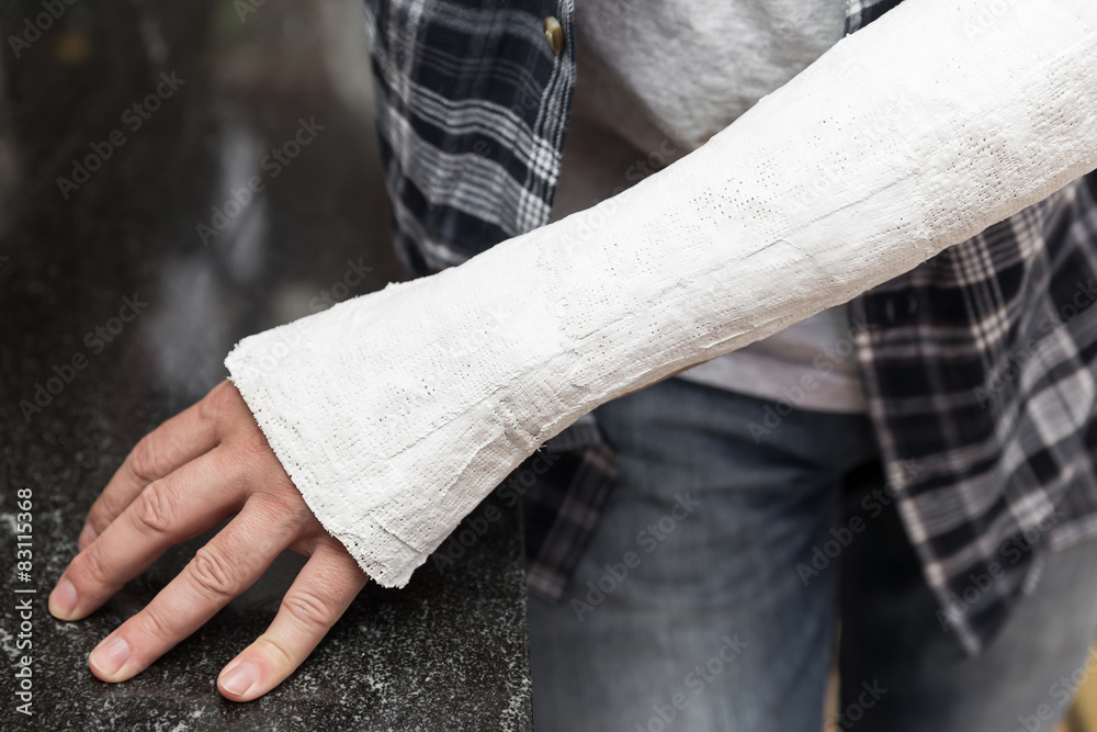 Fototapeta premium Mann lehnt mit eingegipsten Fingern an Küchenzeile