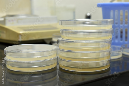 Many petri dishes with culture medium in laboratory.