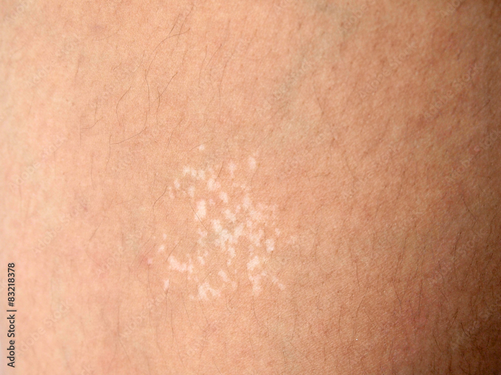 Fototapeta premium Background of the human skin. macro