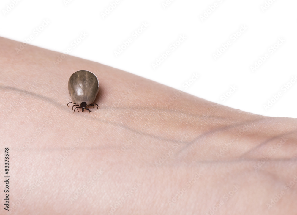 Obraz premium Tick on a skin