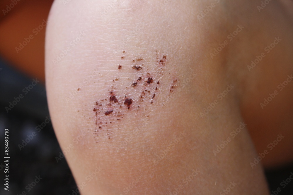 Fototapeta premium Bobo d'enfant