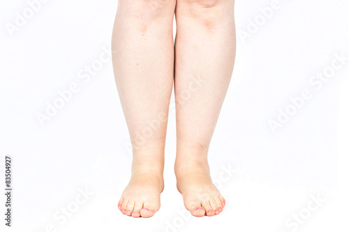 Fotografia legs obese