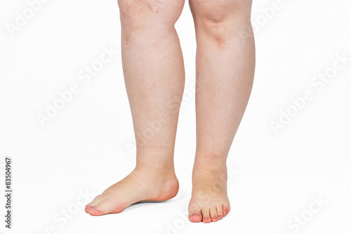 Fotografie, Obraz legs obese