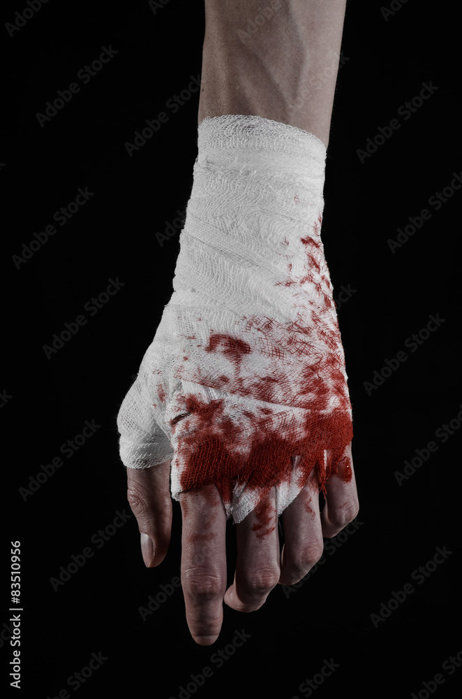 bloody hand in a bandage, bloody bandage, black background Photos | Adobe  Stock