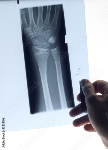 Woman holding x-ray photo