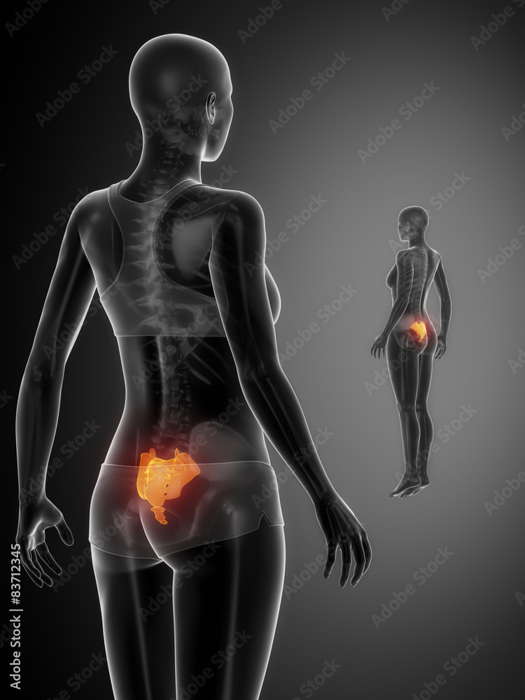 SACRUM black x--ray bone scan SACRUM black x--ray bone scan