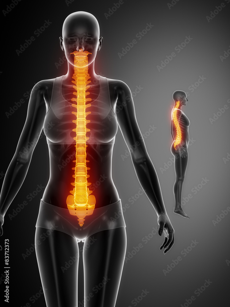 SPINE black x--ray bone scan SPINE black x--ray bone scan