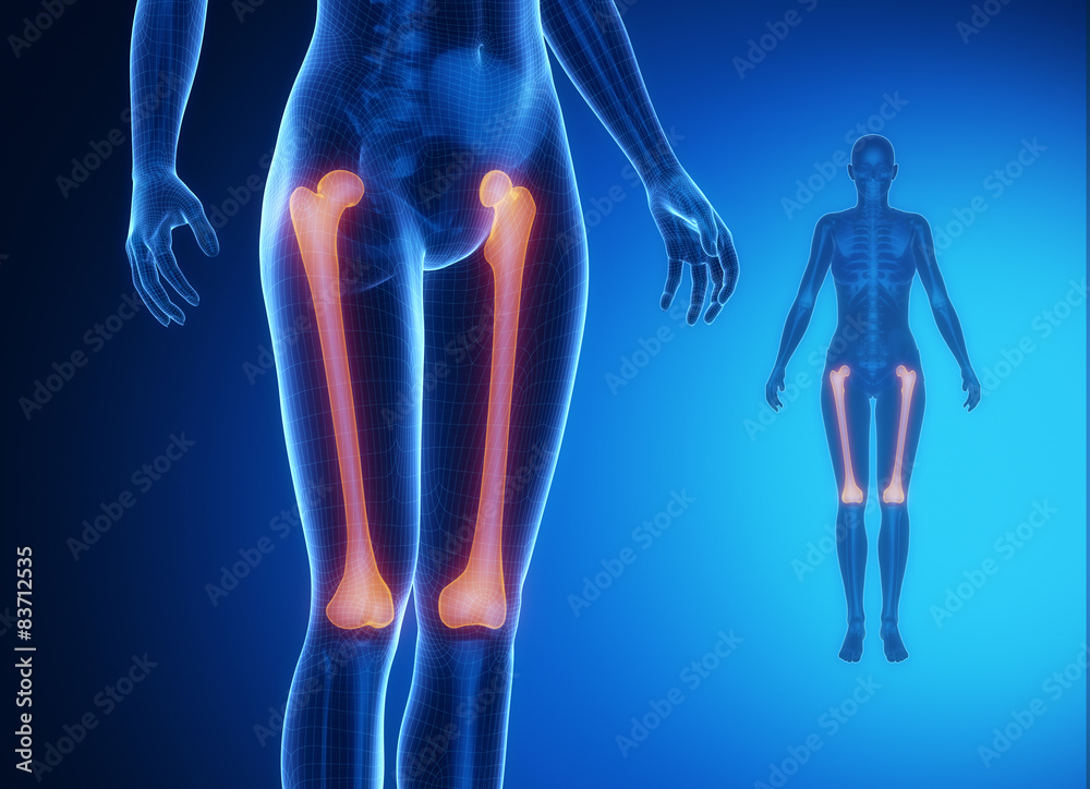FEMUR blue x--ray bone scan FEMUR blue x--ray bone scan