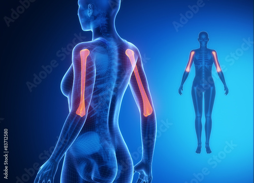HUMERUS blue x--ray bone scan