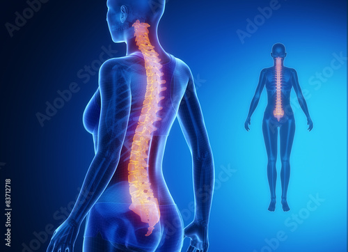 Naklejka SPINE blue x--ray bone scan