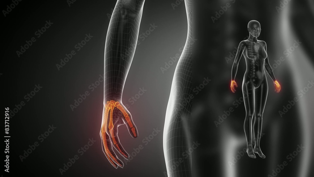 WRIST bone skeleton x-ray scan in black