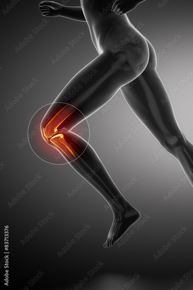 Running woman - knee anatomy Running woman - knee anatomy