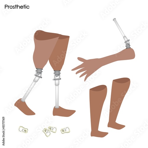 Set of Prosthetic Leg, Knee and Arm