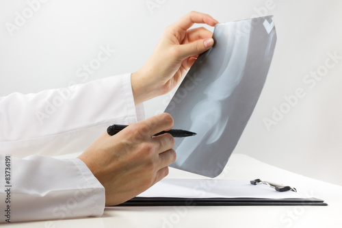 Quadro em tela doctor with medical clipboard analyzing leg knee roentgen