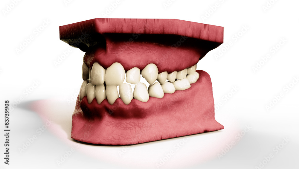Jaw