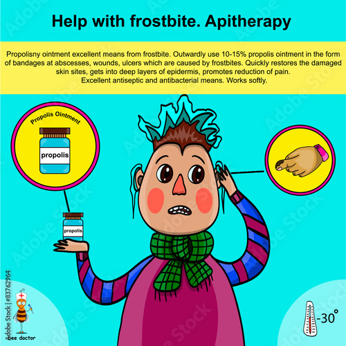 Help with frostbite. Apitherapy